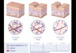 都在問的乙酰殼糖胺（NAG）功效怎么樣？功效成分的護(hù)膚品應(yīng)該怎么選？