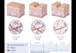 水潤皮膚的秘密武器，乙酰殼糖胺和透明質(zhì)酸的甜蜜聯(lián)盟！